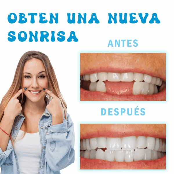 Resina Moldeable para Reparación Dental - Imagen 2